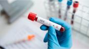 La OMS recomendó una inyección preventiva contra el VIH