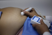 Hospital de Ecuador ofrece disculpas a venezolana esterilizada con coerción cuando era menor de edad