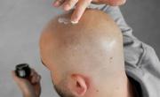 La esperanza científica de los pelados: hallaron la molécula que impulsa el crecimiento del pelo