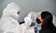 Tarija registra 4 casos de Covid-19 y un caso de Leishmaniasis en la semana epidemiológica 28