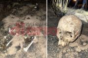 Hallan esqueleto humano semienterrado y sospechan que es de un vecino desaparecido