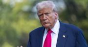 La Casa Blanca reveló que Trump sufre de una enfermedad crónica, lo descubrieron por una hinchazón en las piernas