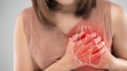 Identificaron una nueva causa de aterosclerosis que revoluciona su tratamiento: de qué se trata