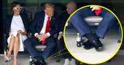 Preocupación por las piernas hinchadas de Donald Trump: qué le diagnosticaron