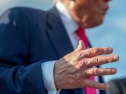 Las fotos que generaron preocupación por la salud de Donald Trump: tobillos hinchados y moretones en las manos