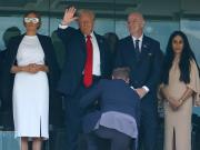 Estados Unidos: la Casa Blanca reveló que Donald Trump sufre insuficiencia venosa crónica