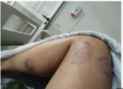 Delincuentes arrastran y agreden a una universitaria