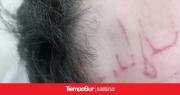 Lo golpearon en banda y lo mandaron al hospital