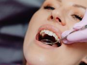 Manuel Viso, doctor: “Hay alimentos que parecen inofensivos pero son un peligro para tus dientes”