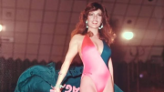 Ex Miss Monagas Yesenia Maurera revela lucha contra Biopolímeros: requiere cirugía inmediata y apoyo económico