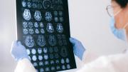 LA PANDEMIA DEL COVID-19 PROVOCÓ EL AUMENTO DEL ENVEJECIMIENTO CEREBRAL PREMATURO