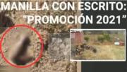 “Tiene una manilla de la promoción 2021”, Determinan que el brazo desmembrado es de una mujer de 25 años
