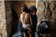 Los habitantes hambrientos de Gaza son “cadáveres andantes”, afirma la UNRWA