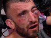 Escalofriante lesión en UFC Abu Dhabi: Mohammad Yahya quedó con un ojo a punto de explotar y pararon su pelea con Steven Nguyen