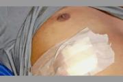 Delincuentes acuchillaron a un joven en el abdomen para robarle un celular