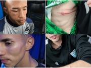 Victoriano Arenas mostró las heridas de cuatro de sus jugadores y Luis Ventura, que sigue internado, denunció: Liberaron a los barras para que nos masacren