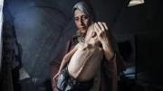 La historia de la foto de Hedaya y su bebé que simboliza la hambruna causada por Israel, una de las imágenes más impactantes