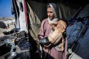 La Sanidad gazatí denuncia otras 14 muertes relacionadas con la desnutrición en la Franja