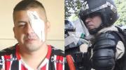 Identificaron al prefecto que le disparó en el ojo a Jonathan Navarro