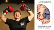 ¿Qué es un ACV isquémico? La enfermedad silenciosa que terminó con la vida de la “Locomotora” Oliveras
