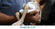 El hambre azota a los hospitales de Gaza: no hay alimentos, las enfermeras se desmayan y escasea la leche para bebés