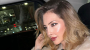 Sacha Fitness revela todo su tratamiento facial: incluye botox y luz pulsada