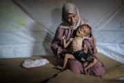 Premier de Israel afirma que nadie pasa hambre en Gaza; hay datos y testigos que lo contradicen