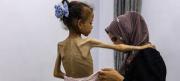 Según la ONU la hambruna en Gaza recuerda a las tragedias de Etiopía y Biafra