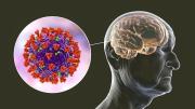 La pandemia de Covid-19 aceleró el envejecimiento del cerebro, según la Universidad de Nottingham