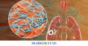 Argentinos desarrollaron un test rápido y de bajo costo para el diagnóstico de la tuberculosis