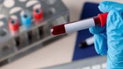 Ni a los 18 ni a los 40 años: esta es la edad en la que se prenden las alarmas por la incidencia del colesterol en tu organismo y así debes prevenir