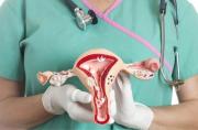 Cáncer de ovario: los cinco síntomas que se confunden con una molestia intestinal