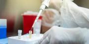 El PAMI hizo un cambio en el servicio de los laboratorios en Capital