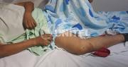 Mecánico atracado y atropellado, tuvo que internarse en una clínica tras no hallar espacio en hospitales públicos