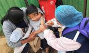 Bolivia reporta 205 casos de sarampión y Salud llama a apoyar acciones para contener el brote