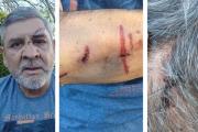 Le partieron la cara a comisionado de El Zanjón en brutal robo: Un detenido
