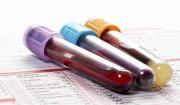 Claves para vivir más de 100 años: lo que la ciencia encontró en la sangre de los longevos