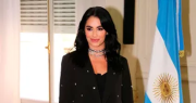 Lali Espósito recordó como, de niña, en el hospital Garrahan le salvaron la mano
