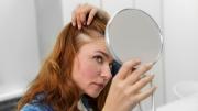 ¡Peligro de calvicie! Deja de comer de inmediato estos alimentos para evitar la caída del cabello: cambia tu menú para mejorar la salud capilar