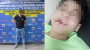 Ministerio Público imputa al responsable de agredir a un niño en La Vega: se confirma una segunda víctima