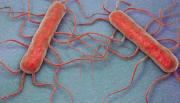 Bacteria en quesos: que es lysteria monocytogenes y cómo prevenirla