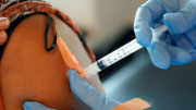 Nueva vacuna en EEUU desafía mutaciones letales y cambia el rumbo de la oncología: pacientes con este cáncer permanecen libres de la enfermedad