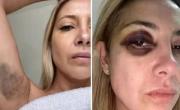 Piden que Alberto Fernández vaya a juicio por violencia de género contra Fabiola Yáñez
