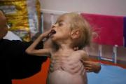 ONU advirtió esta semana que el hambre y la desnutrición en Gaza están en los niveles más altos, mientras Netanyahu niega el hambre