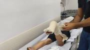 Uno de los hinchas de Godoy Cruz deberá ser operado tras ser agredido por la policía de Brasil