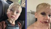 Cámaras revelan la verdad detrás de las heridas de un niño en Georgia: trabajadora arrestada por este delito