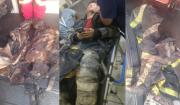 Denuncian que bomberos heridos en explosión no contaban con equipos adecuados