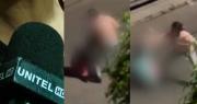 “Me querían reventar la cabeza”: el aterrador relato de la mujer agredida por pedir que bajen el volumen en un local