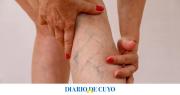 Cómo mejorar la circulación sanguínea en casa con hábitos simples