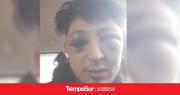 Ariel Carrizo: “Me quisieron matar y no pudieron”